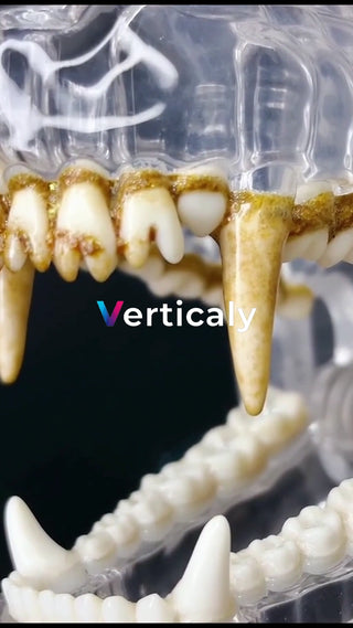 歯の模型、歯周病の様子