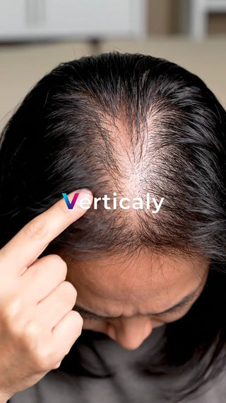 髪のボリュームチェック