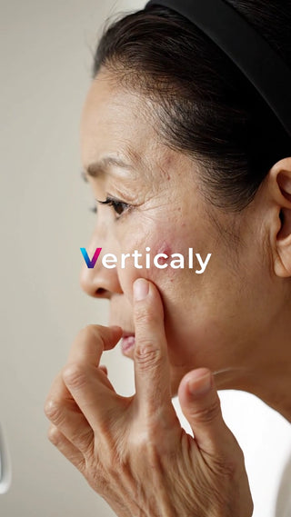 ニキビを気にする女性