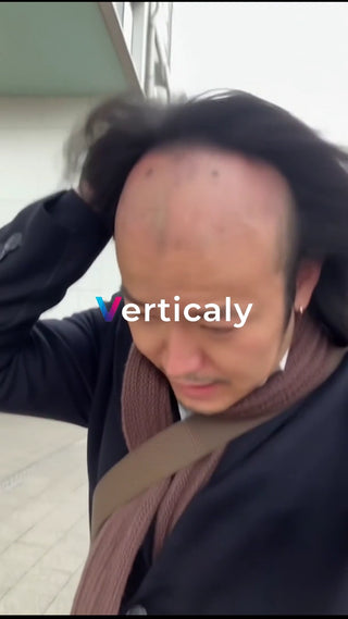 薄毛を気にする男性